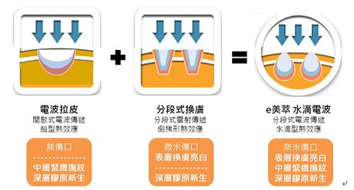 拉皮技術電波拉皮無修復期水滴電波拉皮Ultherapy 極線音波拉皮旭彤診所004.jpg