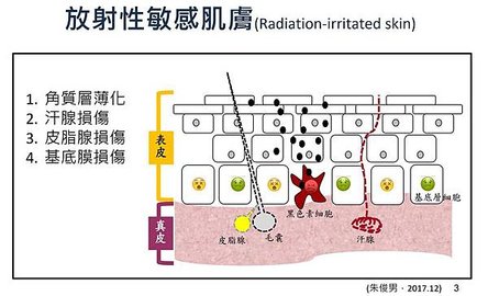 放射性敏感肌膚.jpg