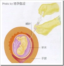 羊膜穿刺圖