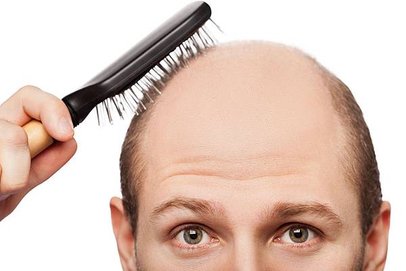 HairLoss-BrushingHair7.jpg