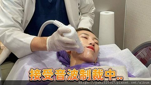 台北音波拉提診所分享 愛爾麗診所 𝐇𝐢𝐏𝐑𝐎-𝐒 龍捲風音波