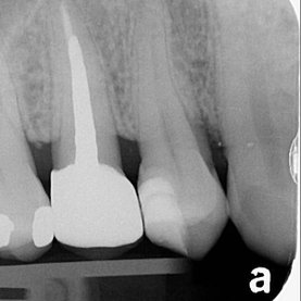 dentalwork on IG 2.006