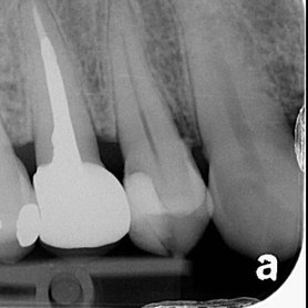 dentalwork on IG 2.005