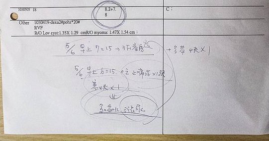 tn_取卵後 排卵針腹部積水回診20140505 (10)_1