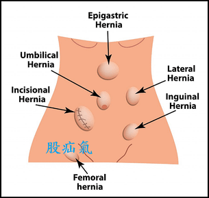 未命名.png