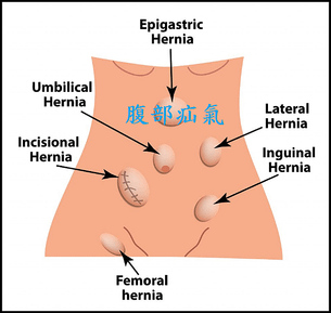 未命名.png