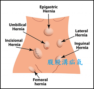 未命名.png