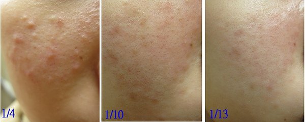 2010-11-19吳念真前-科1 合併.jpg