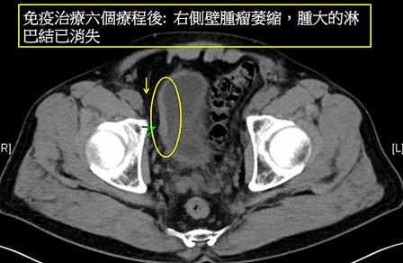 螢幕快照 2020-04-03 13.39.26.png