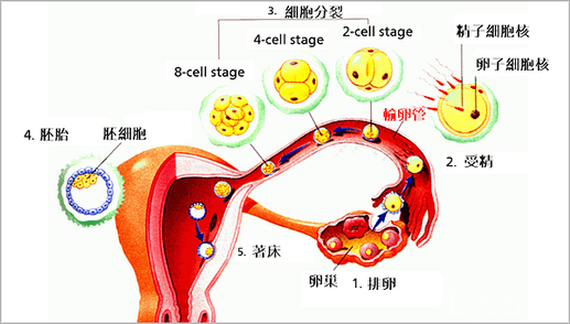 輸卵管阻塞.png