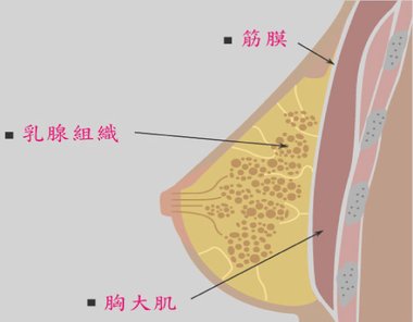 台中隆乳｜台中隆乳手術11.jpg