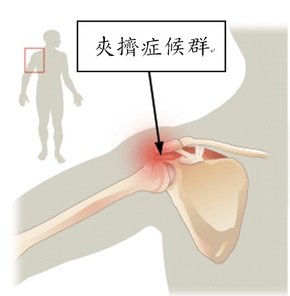 Shoulder joint 05