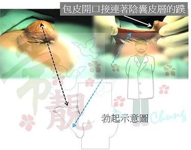 術前.jpg