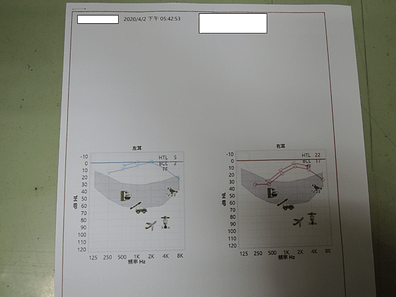 針灸前聽力受損報告.png