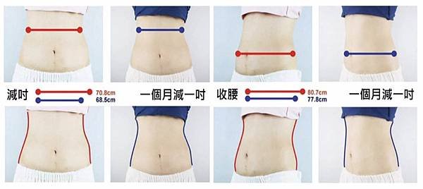 The Pursuit of Perfection-Coolsculpting1
