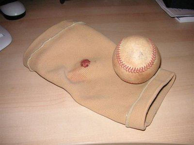 染血的護膝(裡)與冠軍賽勝利球
