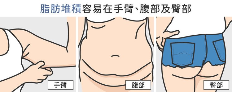 冷凍溶脂冷凍減脂MICOOL-S冷凍溶脂非侵入式體雕瘦身瘦肚子林上立醫生林上立醫師上立皮膚科診所瘦肚子冷凍減脂MICOOL-S台北哪裡做02.jpg