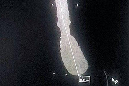 [奇特]全世界陰莖最大的「神鵰俠」