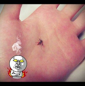 0717死蚊子