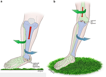 ankle-ACL.png