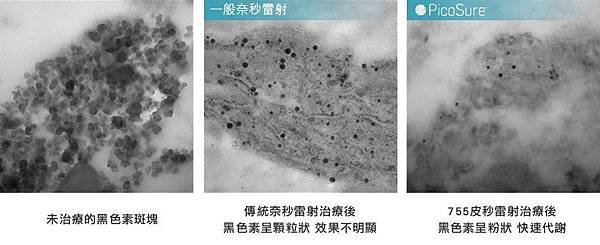 皮秒雷射價格皮秒雷射副作用彤曜時尚診所沈育如醫師高雄皮膚科推薦高雄皮秒雷射皮秒雷射高雄皮秒雷射多久打一次皮秒雷射術後蜂巢皮秒雷射凹洞755蜂巢皮秒雷射2.jpg