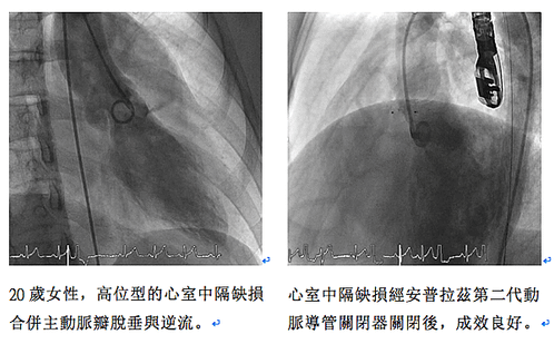 螢幕快照 2017-08-04 下午10.38.37.png