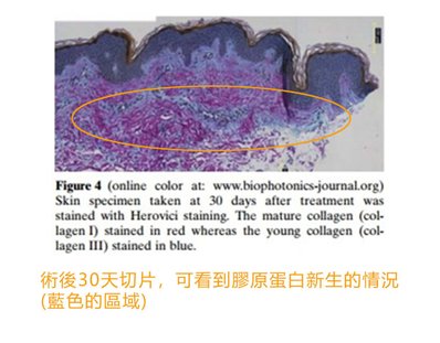 術後30天的膠原蛋白.jpg