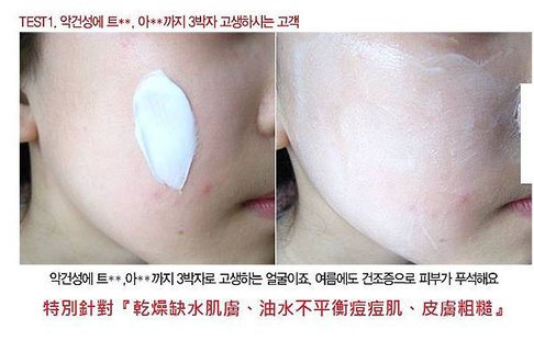皮膚類型