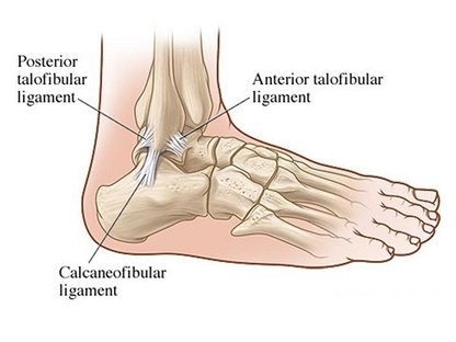 Anterior Talofibular Ligament.jpg