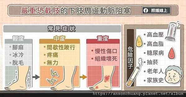 下肢動脈阻塞