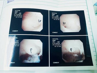 tn_台大楊政憲 照子宮鏡2013-07-10 (11)