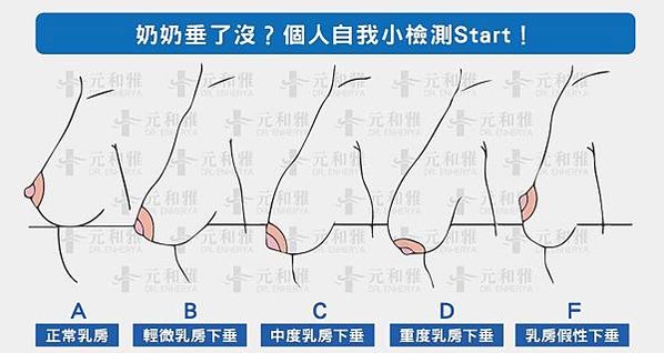 元和雅 乳房檢視