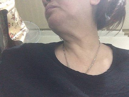 15.iHDoc童妍光 純素膠原蛋白  小潔 15