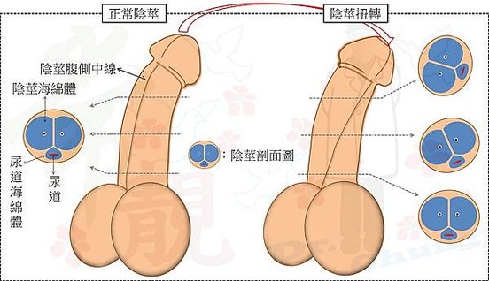 扭轉示意圖.jpg