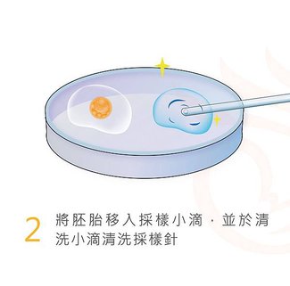 胚胎著床前染色體篩檢-02.jpg