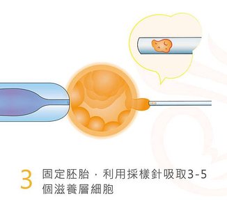 胚胎著床前染色體篩檢-05.jpg