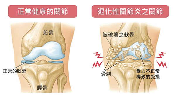 葡萄糖胺飲