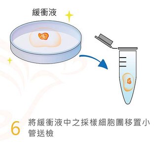 胚胎著床前染色體篩檢-06.jpg