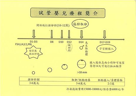 試管嬰兒流程