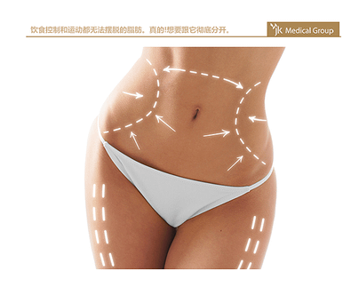 QQ截图20160809182718.png