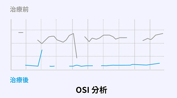 AQUA Care 乾眼護理