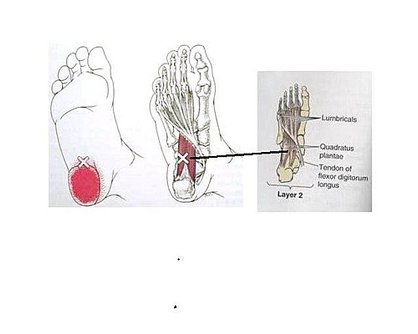 徒手治療對於足底筋膜炎1