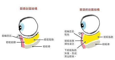 台中眼袋手術｜眼袋手術權威｜台中菲仕美