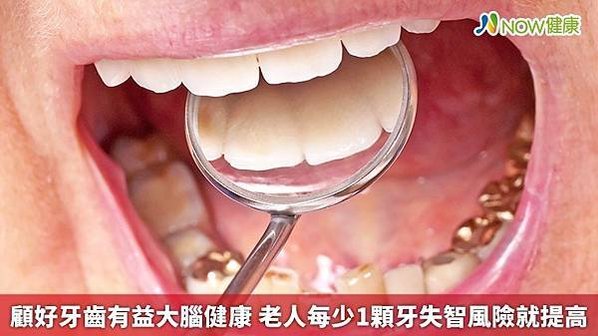 顧好牙齒有益大腦健康 老人每少1顆牙失智風險就提高1