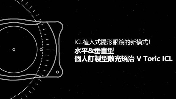 ICL植入式隱形眼鏡的新模式！水平&amp;垂直型個人訂製型散光矯治 V Toric ICL-封面
