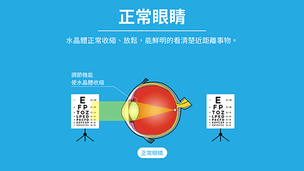 什麼是老花眼？