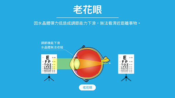 什麼是老花眼？