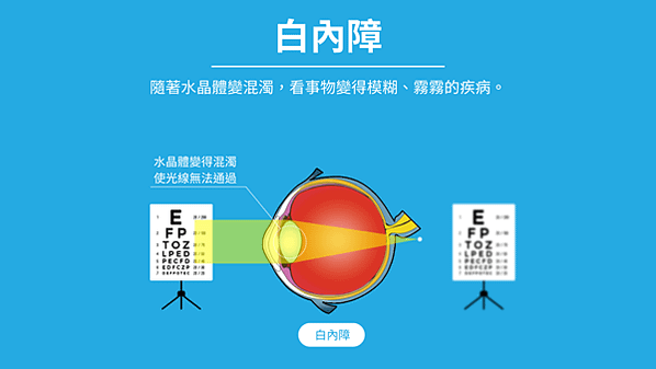 什麼是老花眼？