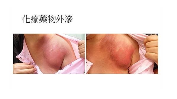 投影片4