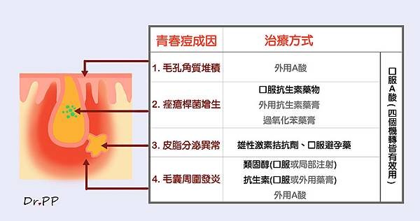 1061111青春痘成因2.jpg